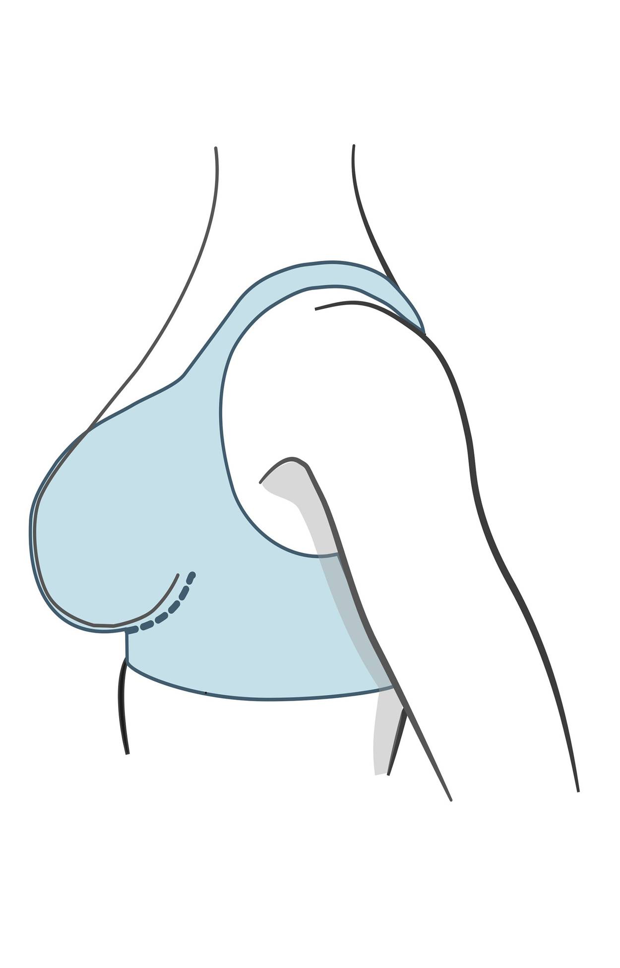 Soutien-gorge Freedom Skin-Relief